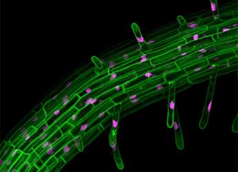 Image showing a root using the fluorescent technique