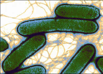 Bacterial Plant Pathogens Cell and Molecular Sciences | Research The James Institute
